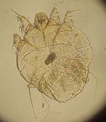190px-Sarcoptes_scabei_2.jpg
