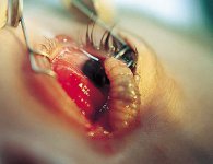 Botfly-eye1.jpg