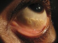 roundworm.jpg