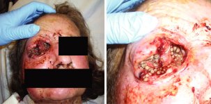 Afriucan-eye-worm1.jpg