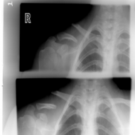 DixieCrystal